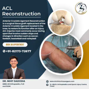 ACL-Reconstruction