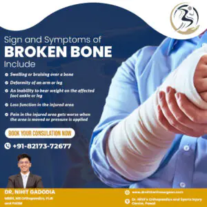Broken-Bone