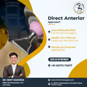 Direct-Anterior-Approach