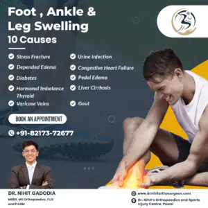Foot-Swelling