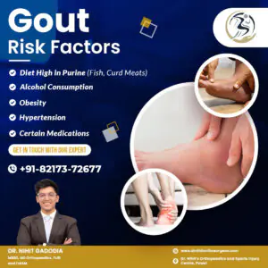 Gout-Risk-Factors