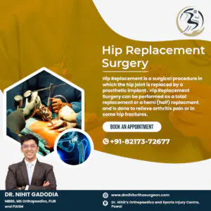 Hip-Replacement