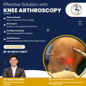 Knee-Arthoscopy