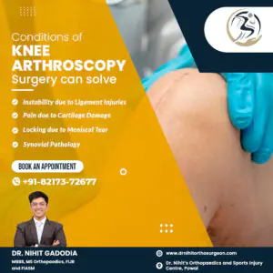 Knee-Arthoscopy-Surgery