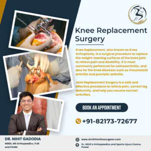 Knee-Replacement-Surgery