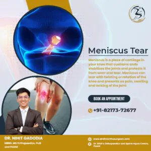 Meniscus-Tear