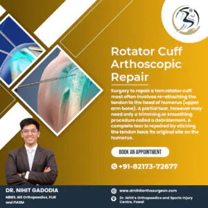 Rotator-Cuff-Arthoscopic-Repair